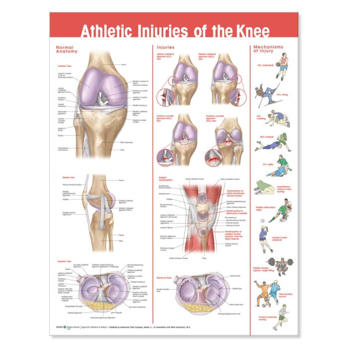 Patterson Medical Athletic Injuries of the Knee Chart