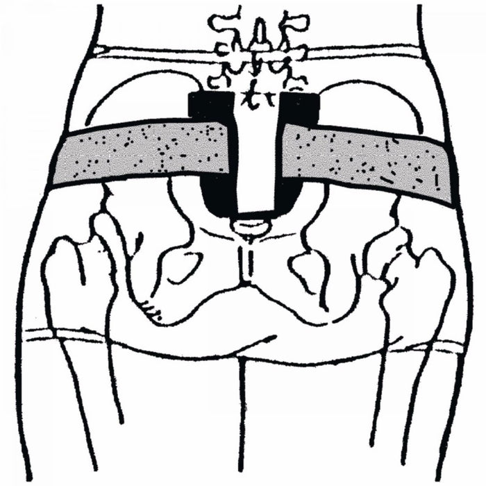 Sammons Preston Sacroiliac Belt