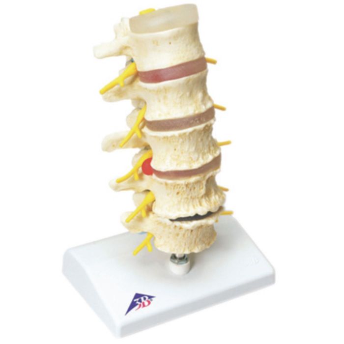 Patterson Medical Anatomical Spine Model