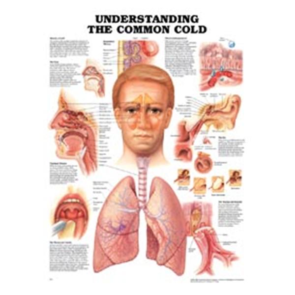 Wolters Kluwer Health  Chart Educational Understanding The Common Cold 20x26" Ea