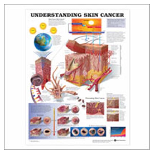 Wolters Kluwer Health  Chart Educational Understanding Skin Cancer 20x26" Ea