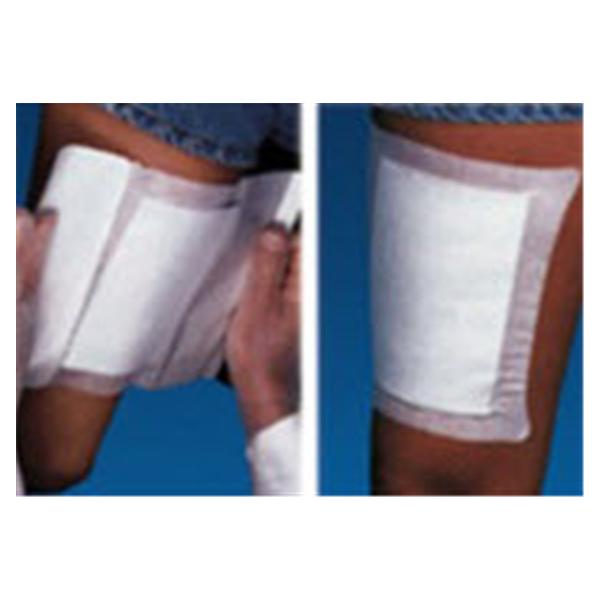 MPM Medical Dressing Gauze WoundGard Cotton 4x4" Non-Sterile 30/Bg