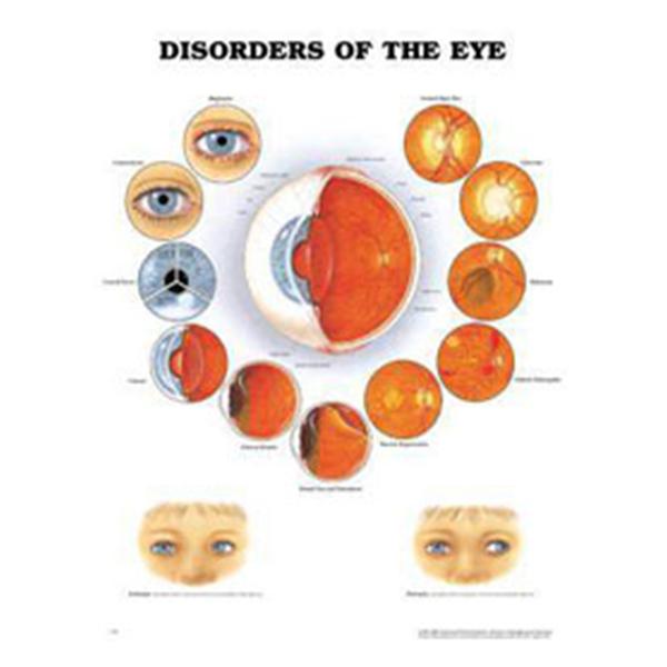 Wolters Kluwer Health  Chart Educational Disorder of the Eye 20x26" Ea