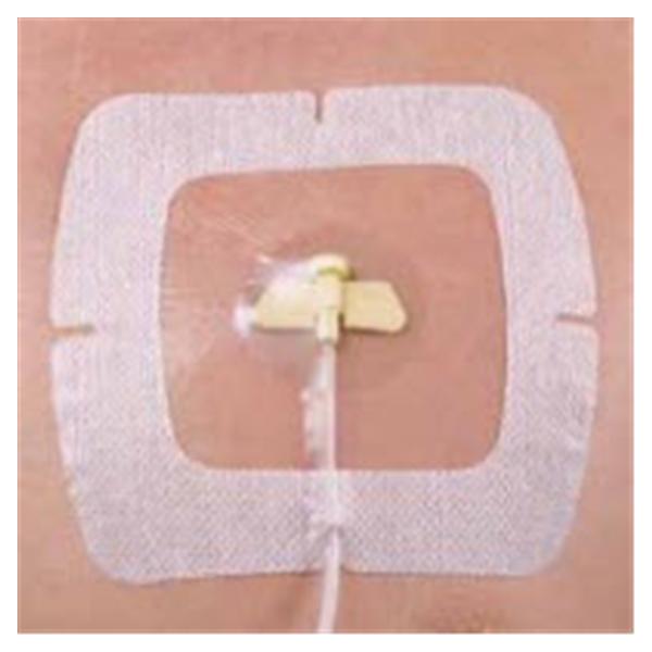 Centurion Medical Products Drsng IV SecureView Port Flm 4.5x4.5 Adhs NAdhr Trans LF 100/Ca