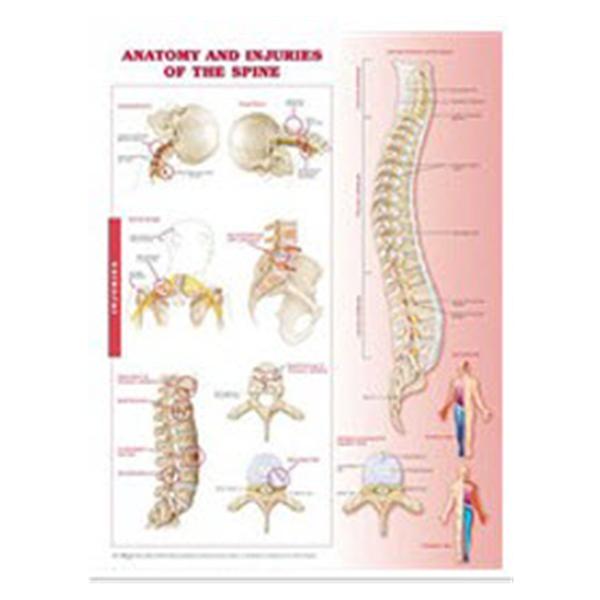 Lippott Williams @ Wilkins Chart Anatomical Anatomy and Injuries of the Spine 20x26" Ea