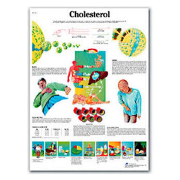 American 3B Chart Anatomical Cholesterol 20x26" Ea