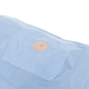 Halyard Health, Inc Minor Procedure Fenestrated Drape - DRAPE, MINOR PROCEDURE, FENESTRATED, 48X60" - 79207