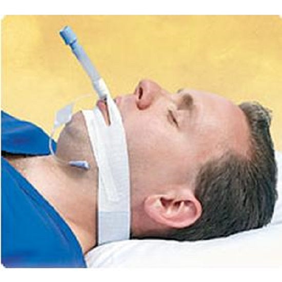 Nurse Assist Trachtape Endotracheal Tube Securing Device