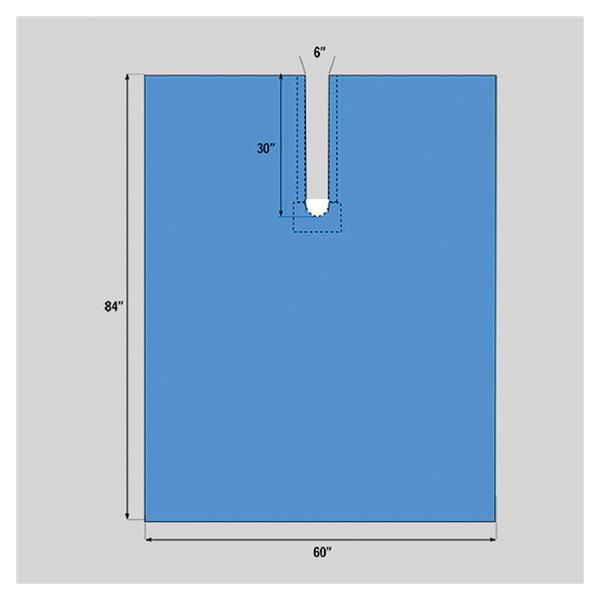 Welmed  Drape Orthopedic U-Shaped Fenestrated 60x84" Sterile Ea, 55 EA/CA (1222-1920)