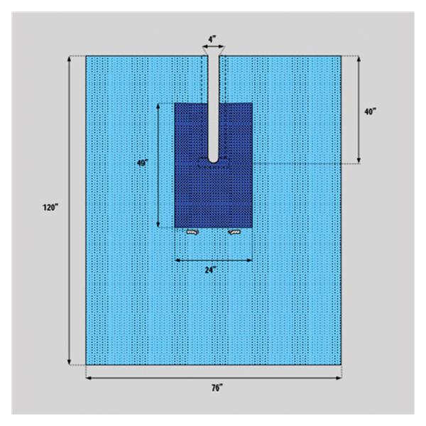 Welmed  Drape Surgical Fenestrated 77x120" Non-Sterile 25/Ca