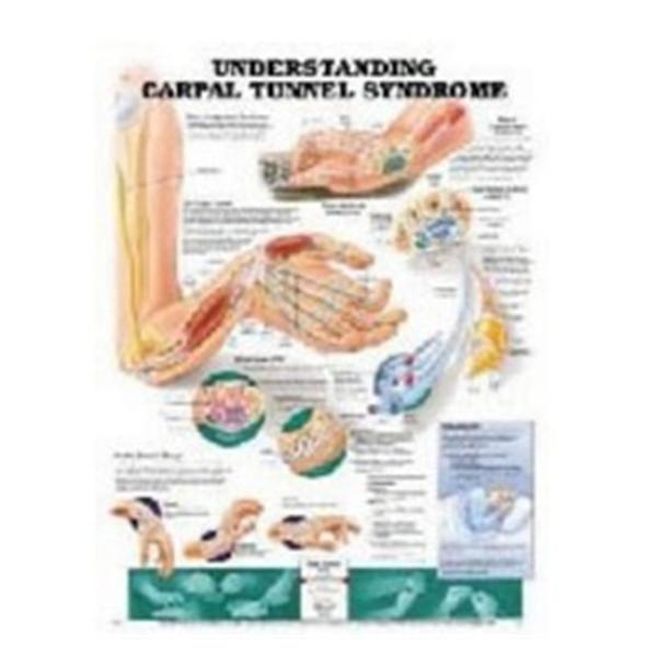 Wolters Kluwer Health  Chart Anatomical Carpel Tunnel Syndrome 20x26" Ea