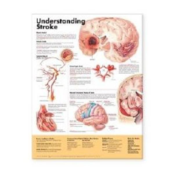 Wolters Kluwer Health  Chart Anatomical Stroke 20x26" Ea