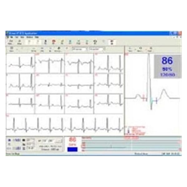 Norav Medical Software Stress Test Ea