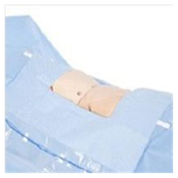 O & M Halyard Drape Abdominal Surgical 18x18 Fen 118x92x124 Bari Blu NS 9/Ca