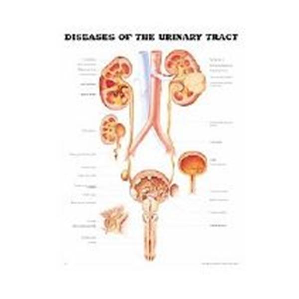 Wolters Kluwer Health  Chart Educational Diseases of Urine Tract 20x26" Ea