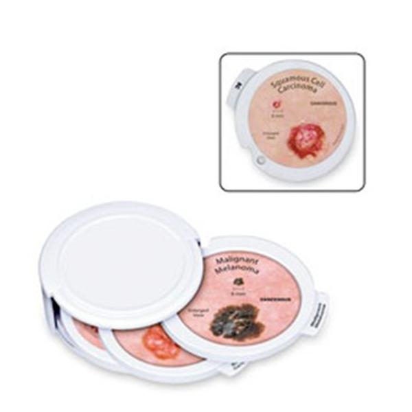 GPI Anatomical Skin Cancer Disk Set Educational Ea