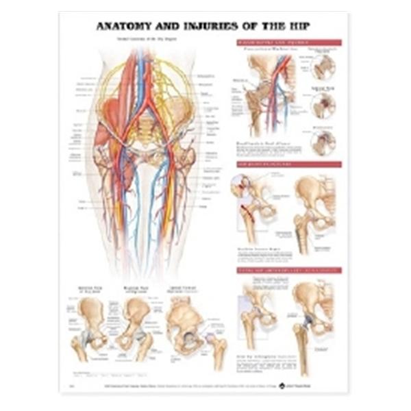 Wolters Kluwer Health  Chart Anatomical Anatomy & Injuries of the Hip 20x26" Ea