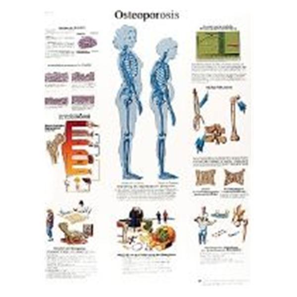 Fabrication Enterprises Chart Anatomical Spinal Column 20x25" Ea (12-4615L)