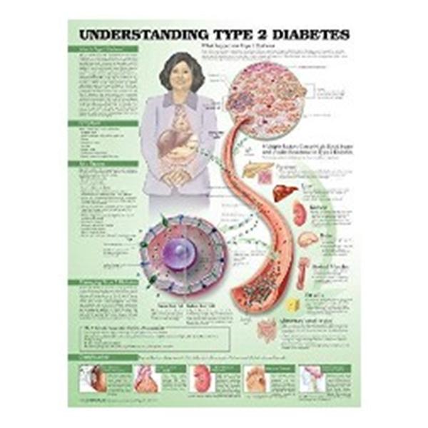 Wolters Kluwer Health  Chart Educational Understanding Type 2 Diabetes 20x26" Ea