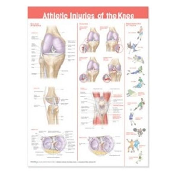 Wolters Kluwer Health  Chart Anatomical Athletic Injuries of The Knee 20x26" Ea