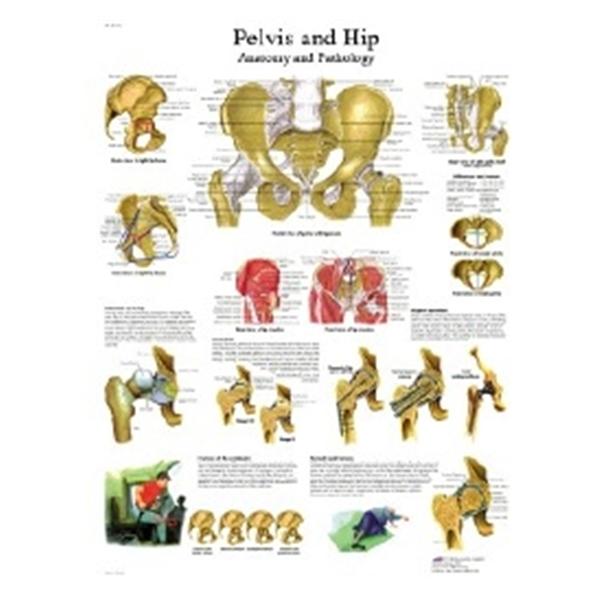 Fabrication Enterprises Chart Hip and Pelvis 20x25" Ea