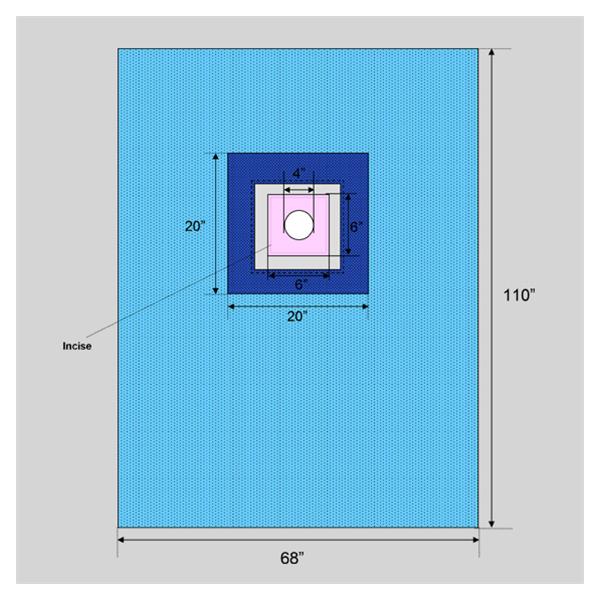 Welmed  Drape Sheet 4" Fenestrated 110x68" Blue Sterile 22/Ca