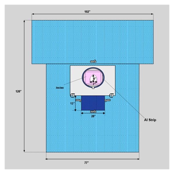 Welmed  Drape Sheet Fenestrated 102x120x77" Blue Sterile 18/Ca