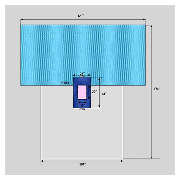 Welmed  Drape Sheet 120x104x174" Blue Sterile 18/Ca