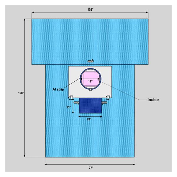 Welmed  Drape Sheet Fenestrated 102x120x77" Blue 18/Ca