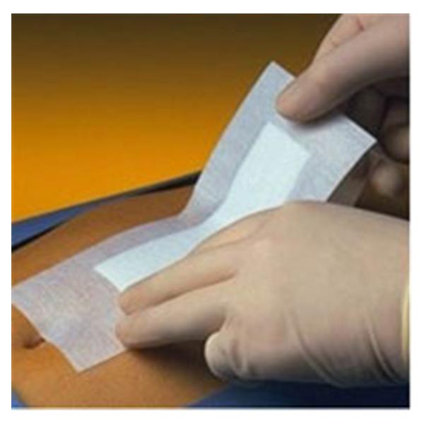 Smith & Nephew Wound Care Dressing Post Op Island Primapore Poly 6x3-1/8" Strl LF 20/Bx, 10 BX/CA (66000318)