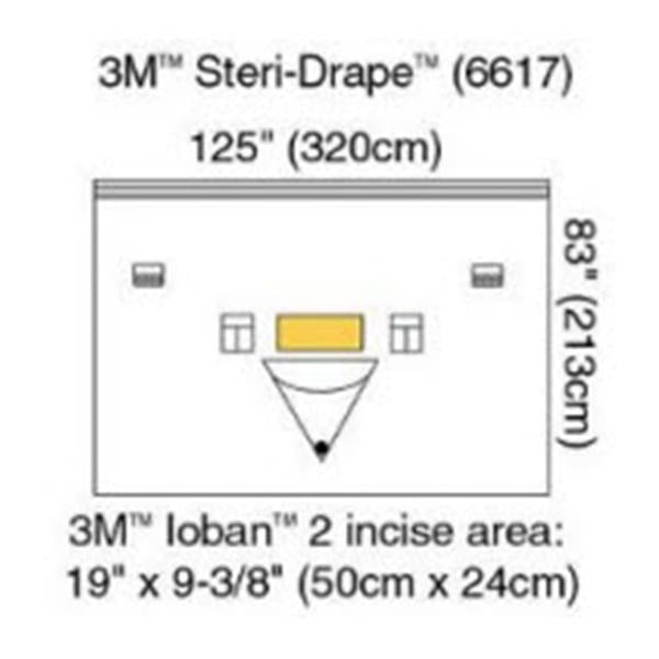 3M Medical Products Drape Isolation Steri-Drape Ioban Plastic 4x5/Ca