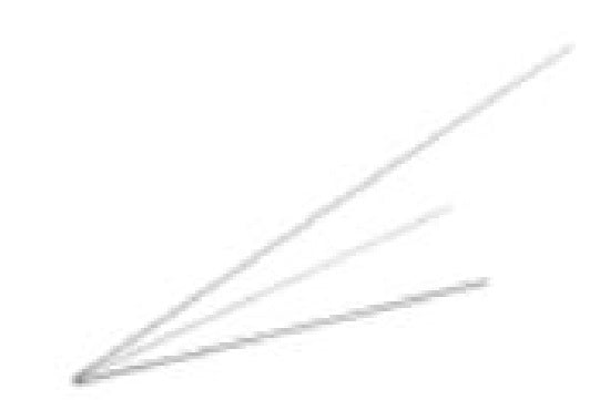 Zimmer Biomet Nitinol Guide Wires - Nitinol Guide Wire, 14" x 1.5 mm - 906850