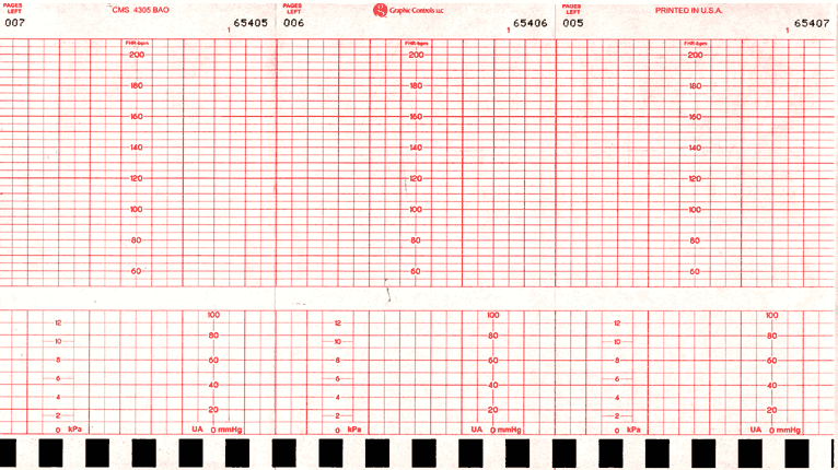 Graphic Controls CMS BAO Chart Paper - CMS BAO 4305 Fetal Chart Paper, 152 mm x 47' - 7G30767589