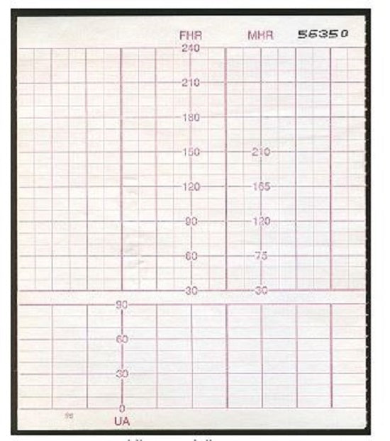 Print Media Corporation ECG Recording Paper - Chart Paper with F-Fold, Red, 120" x 100" x 150" - 1235472