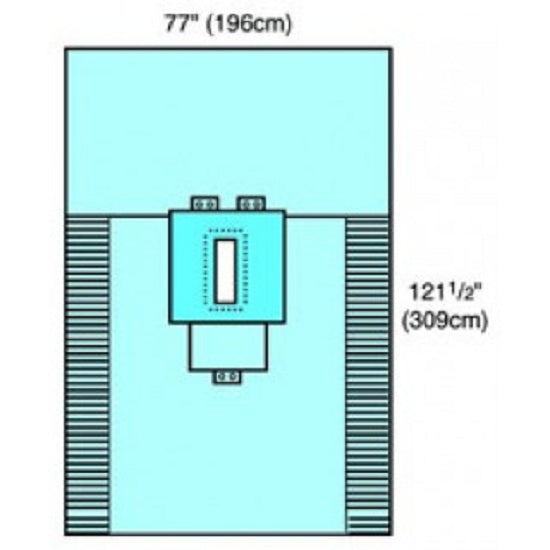 Cardinal Health Laparotomy Packs - Laparotomy Pack - 29120