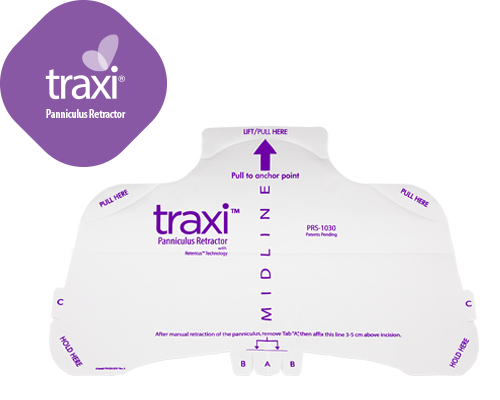 Clinical Innovations Traxi Panniculus Retractor - TRAXI PANNICULUS RETRACTOR EXTENDER - PRS-0550