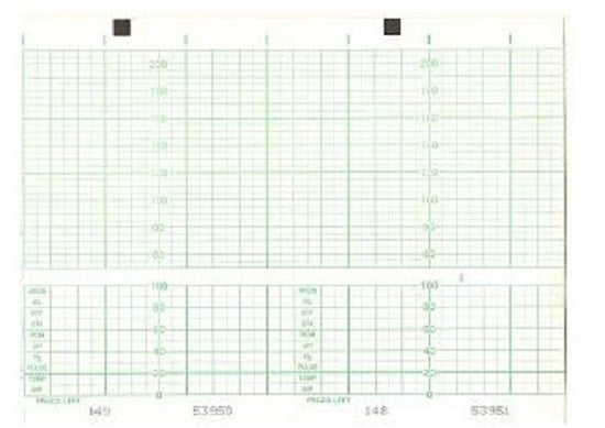 Print Media Corporation Chart Paper - Generic Chart Paper, Fan Fold, 150 x 100 x 150, Green - 2354514