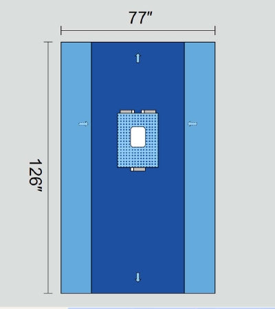 Welmed Inc Laparotomy Drapes - Laparotomy Drape without Arm Board Cover, Pediatric, 77" x 126" - 1222-2125