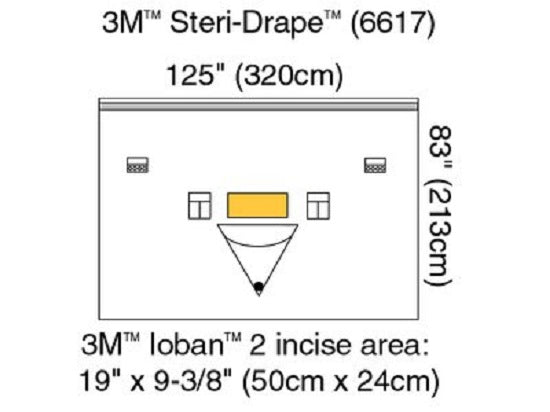 3M Steri-Drape Isolation Drape with Ioban 2 Incise Film - DRAPE, STERIDRAPE, ISOLATION, W/ACCESS - 6617