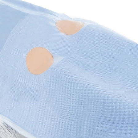 Halyard Health Radial Femoral Drapes - Femoral-Angio Radial Drape, Nonsterile, Size L / XL - 36497NS