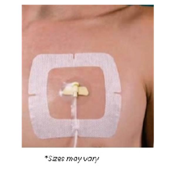 Centurion Medical Products Dressing IV SecureView Port Flm 4x5 Adhs NAdhr Transparent Abs Ea, 50 EA/CA (SCP44VXT)