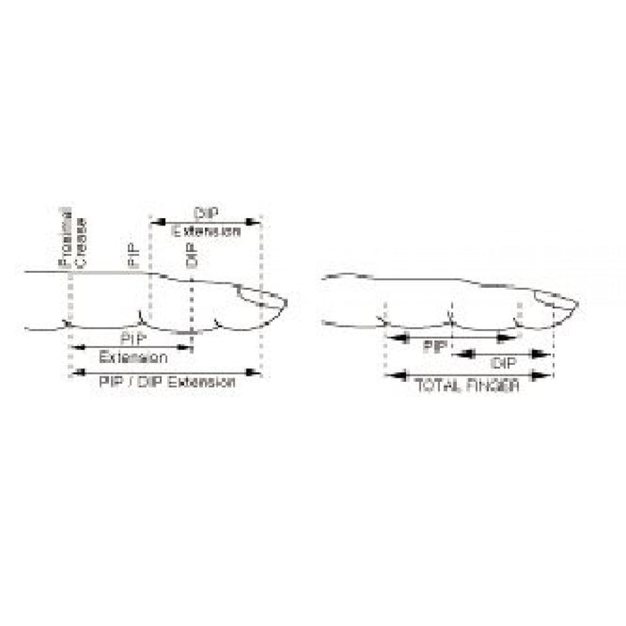 LMB Ulnar LMB Extension Finger Splint