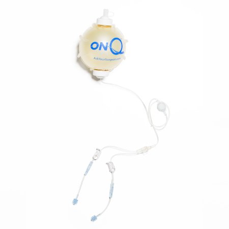 Avanos Medical ON-Q Pump Kits with ON-Q SilverSoaker Catheter - ON-Q Fixed Flow Pump Kit with SilverSoaker Catheter, 26.5", 400 mL x Dual 2 mL / HR - PM028-A