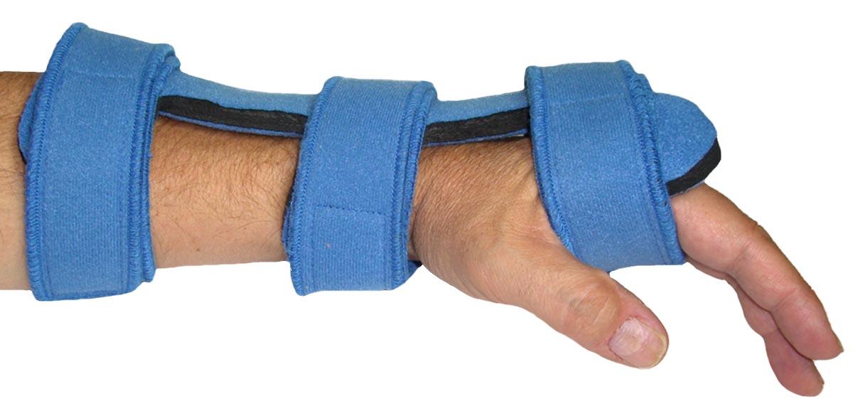 Comfy Splints Comfyprene Splint Dorsal Hand Orthosis - SPLINT, DORSAL HAND, ADULT-L, LTBLU, PRENE - DORSH-101-CP-ADULT-LB-LEFT