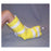 Medical Devices Intl Splint Econo-Vac Wrist/Ankle Vinyl Yellow Ea, 10 EA/CA (82-E2010)