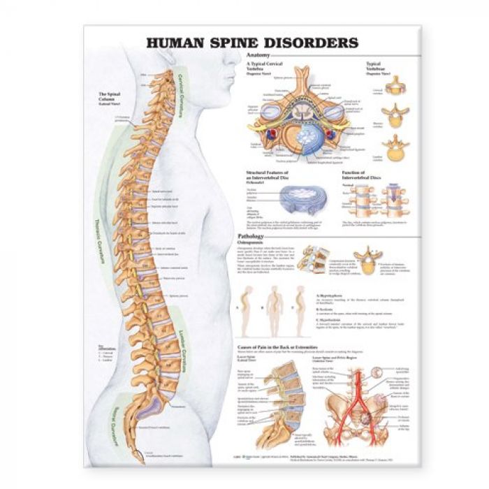 Patterson Medical Human Spine Disorder Chart