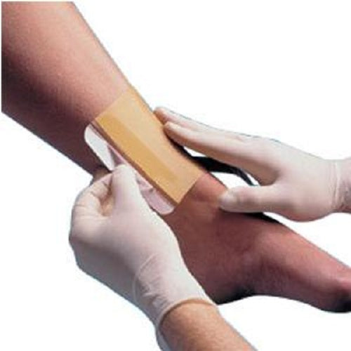 Wound Dressing