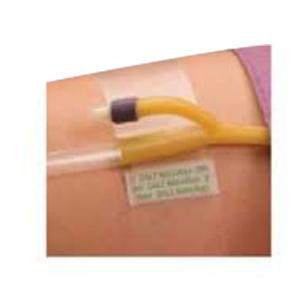 Dale Hold-N-Place Adhesive Patch Foley Catheter Holder, One Size, Latex-Free