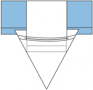 Medline Non Sterile Underbuttocks Drapes - POUCH, UBD - 60815