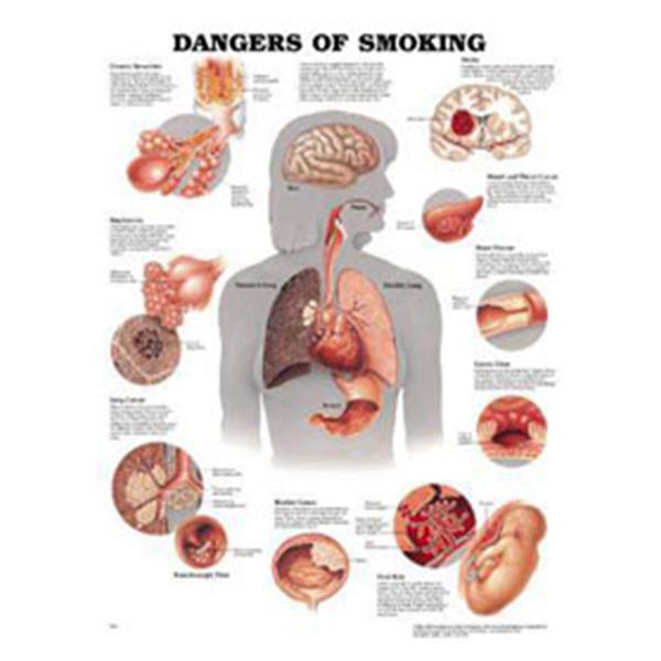 Wolters Kluwer Health  Chart Educational Dangers of Smoking 20x26" EA